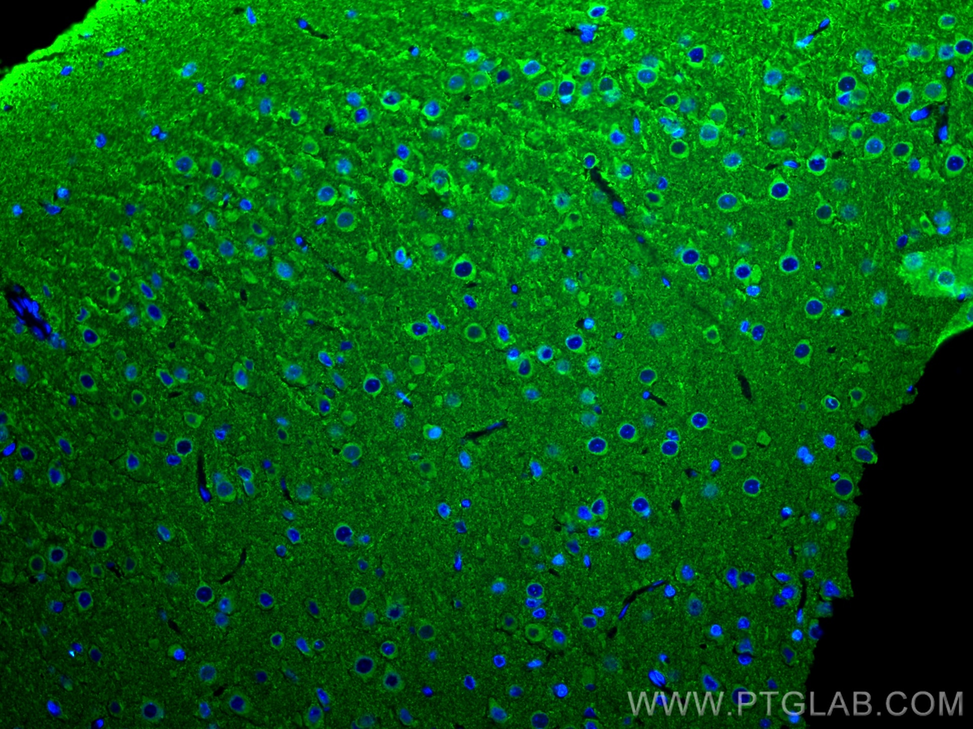 Immunofluorescence (IF) / fluorescent staining of rat brain tissue using Nesprin 2 Polyclonal antibody (25265-1-AP)