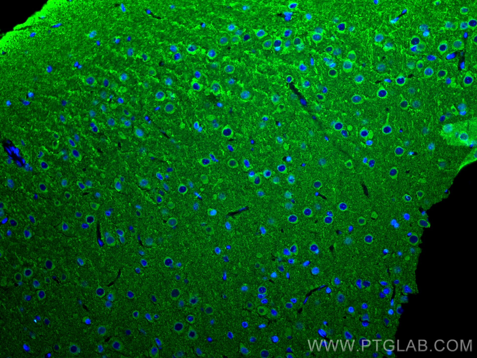 IF Staining of rat brain using 25265-1-AP