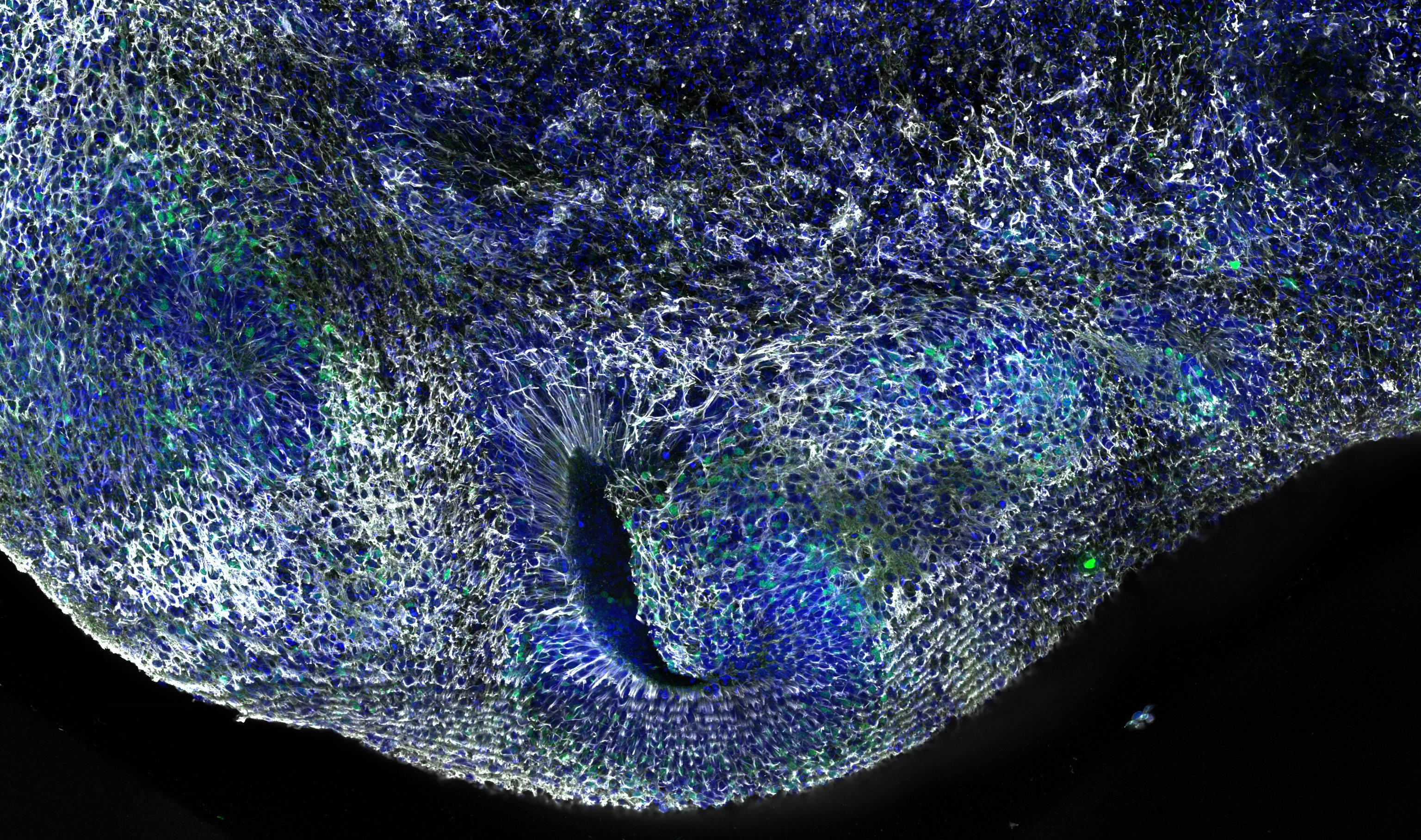 Immunofluorescence (IF) / fluorescent staining of Human dorsal cerebral organoid using Nesprin 2 Polyclonal antibody (25265-1-AP)