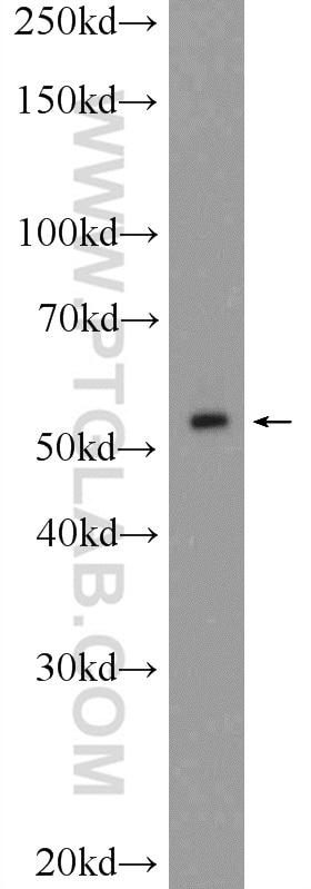 Western Blot (WB) analysis of HEK-293 cells using Nesprin 2 Polyclonal antibody (25265-1-AP)