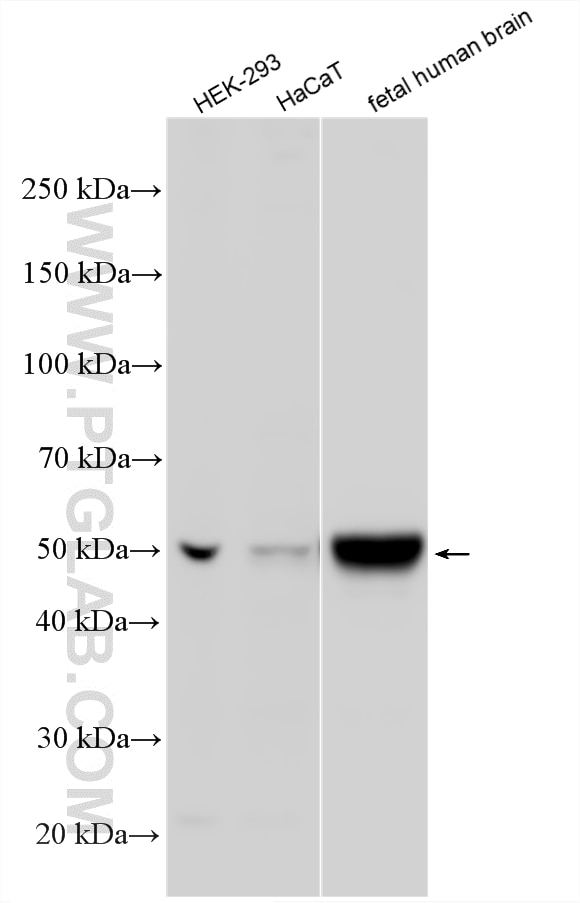 WB analysis using 25265-1-AP Western Blot (WB) analysis of various lysates using Nesprin 2 Polyclonal antibody (25265-1-AP)