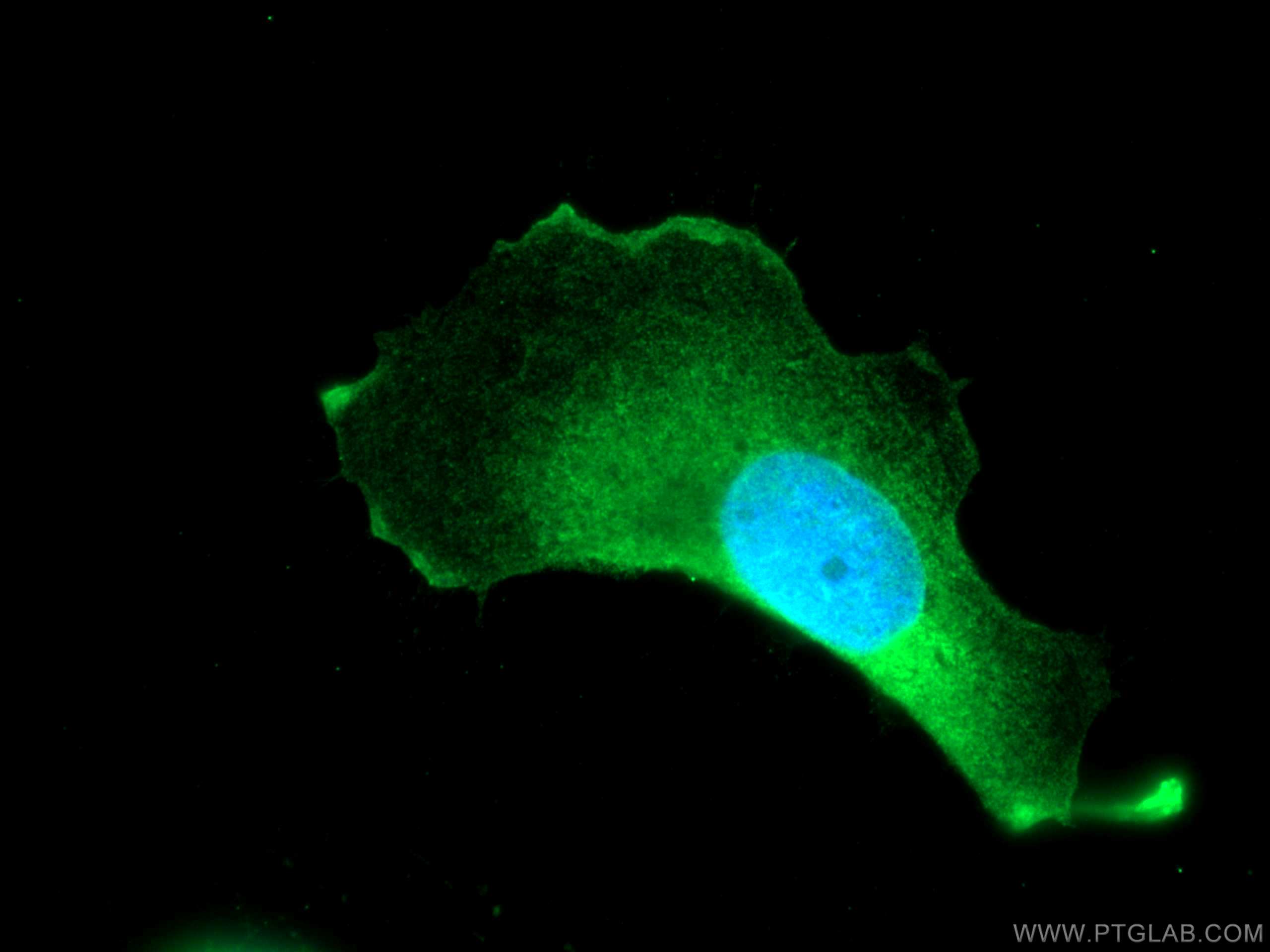 Immunofluorescence (IF) / fluorescent staining of U-251 cells using SYNGAP1 Polyclonal antibody (19739-1-AP)