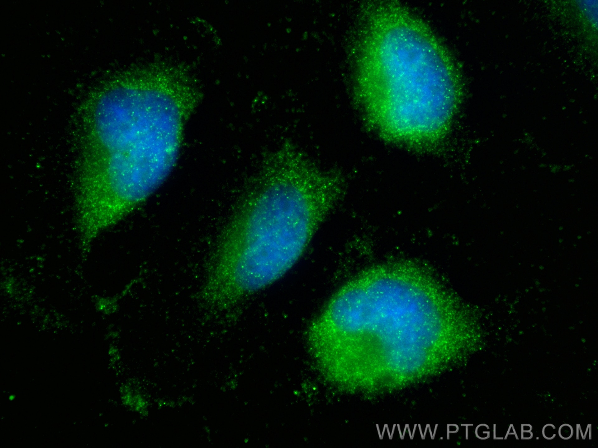 Immunofluorescence (IF) / fluorescent staining of U-251 cells using SYNGAP1 Polyclonal antibody (19739-1-AP)