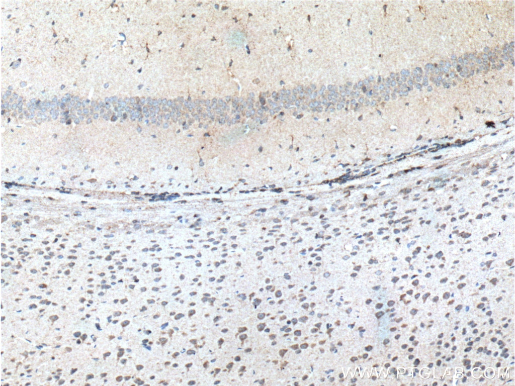 Immunohistochemistry (IHC) staining of mouse brain tissue using SYNGAP1 Polyclonal antibody (19739-1-AP)