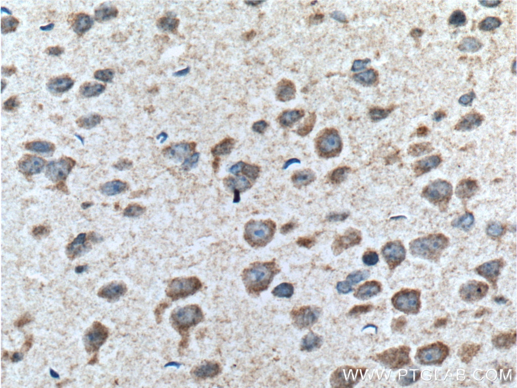 Immunohistochemistry (IHC) staining of mouse brain tissue using SYNGAP1 Polyclonal antibody (19739-1-AP)