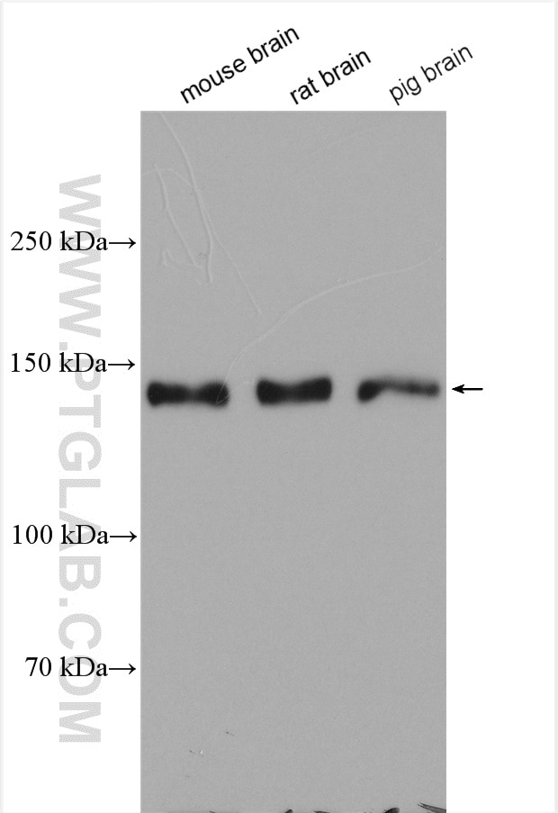 Western Blot (WB) analysis of various lysates using SYNGAP1 Polyclonal antibody (19739-1-AP)