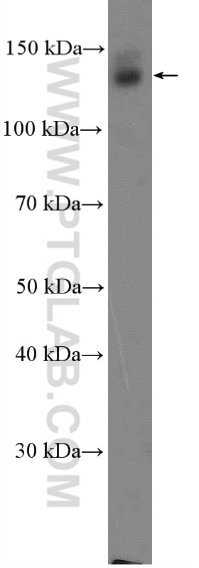 Western Blot (WB) analysis of mouse brain tissue using SYNGAP1 Polyclonal antibody (19739-1-AP)