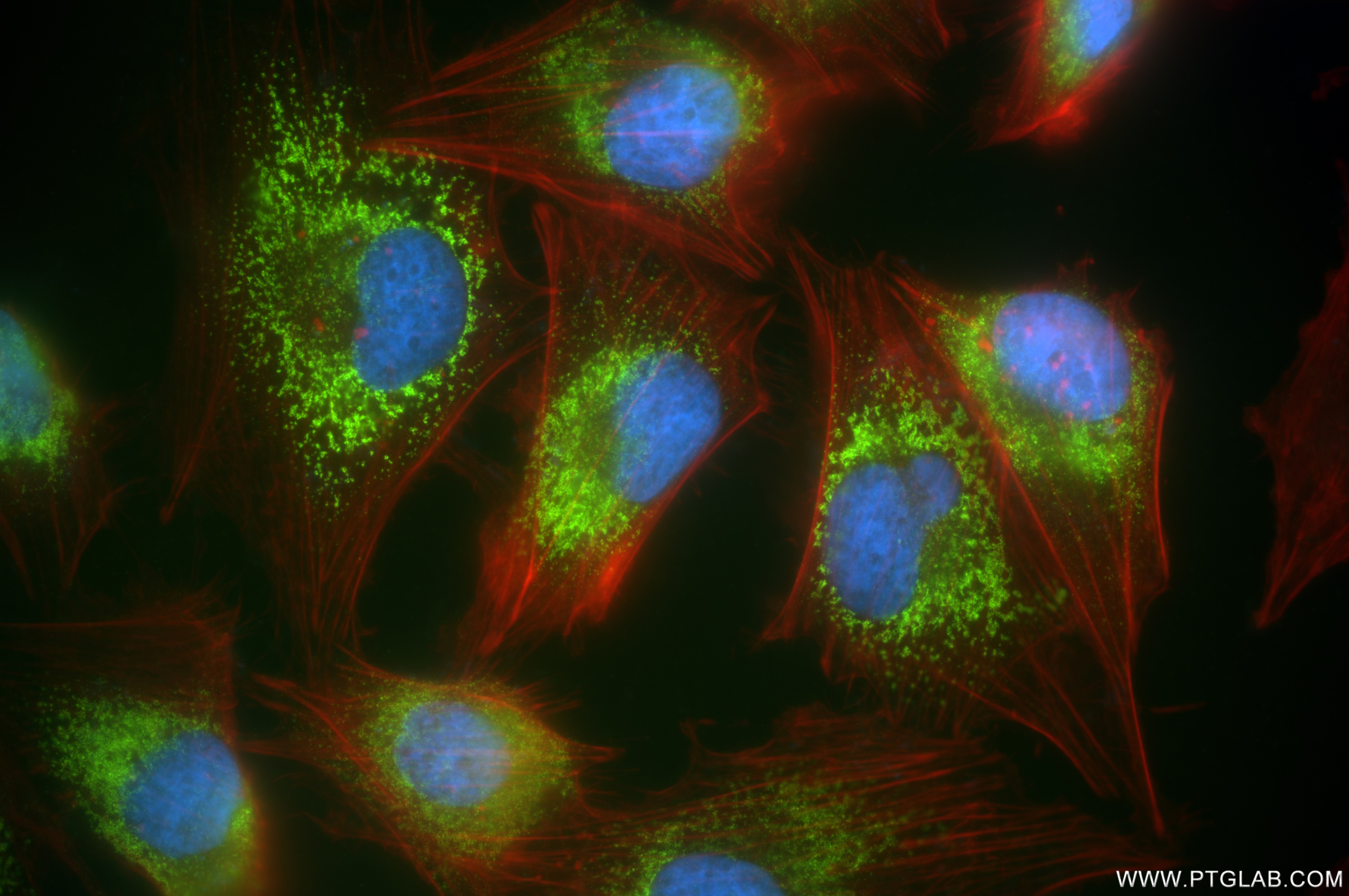 Immunofluorescence (IF) / fluorescent staining of U-251 cells using SYNGAP1 Recombinant antibody (85045-1-RR)