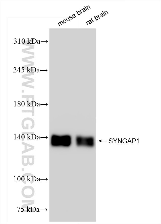 Western Blot (WB) analysis of various lysates using SYNGAP1 Recombinant antibody (85045-1-RR)