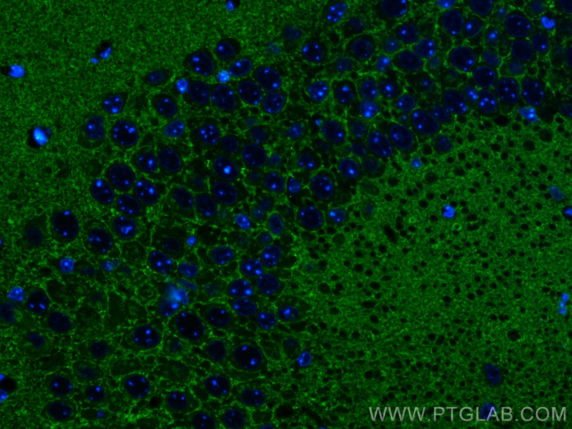 Immunofluorescence (IF) / fluorescent staining of mouse brain tissue using SYNGR1 Monoclonal antibody (68176-1-Ig)
