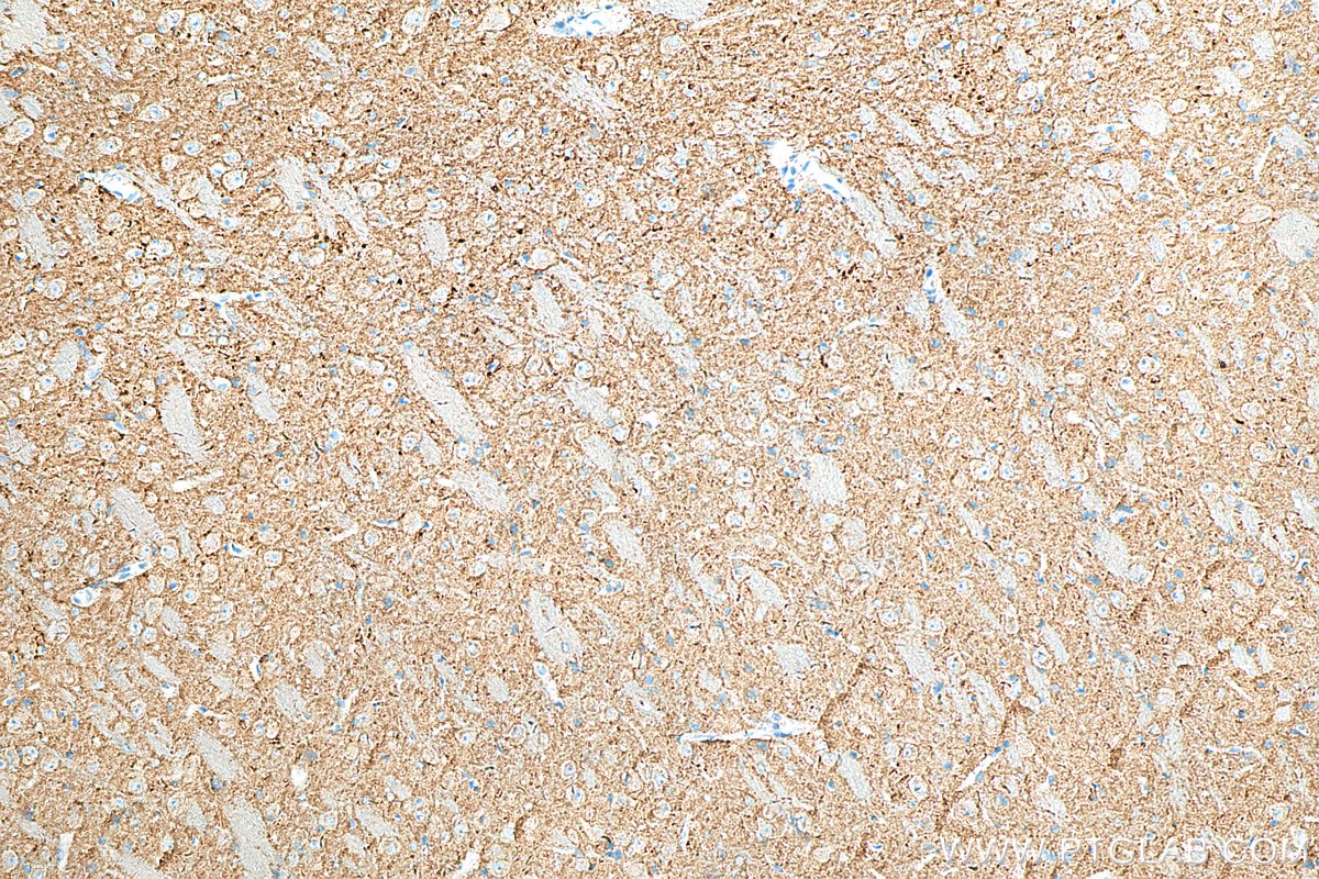 Immunohistochemistry (IHC) staining of rat brain tissue using SYNGR1 Monoclonal antibody (68176-1-Ig)