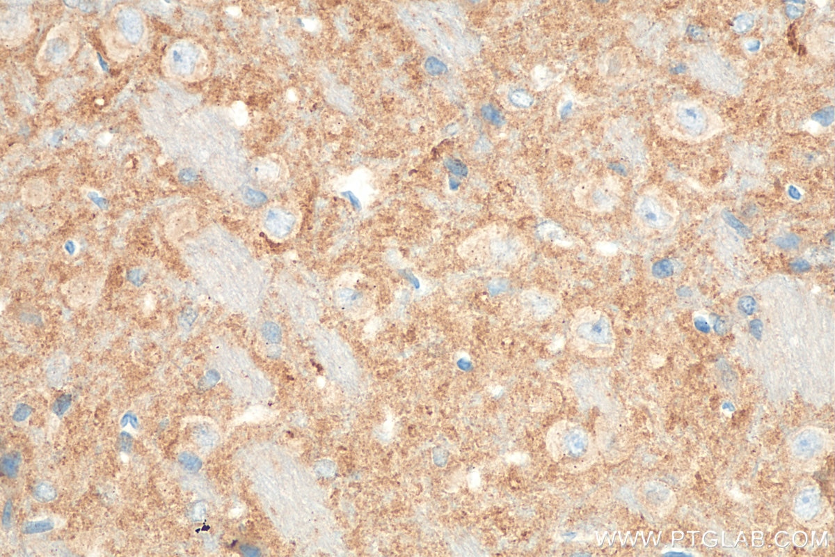 IHC staining of rat brain using 68176-1-Ig