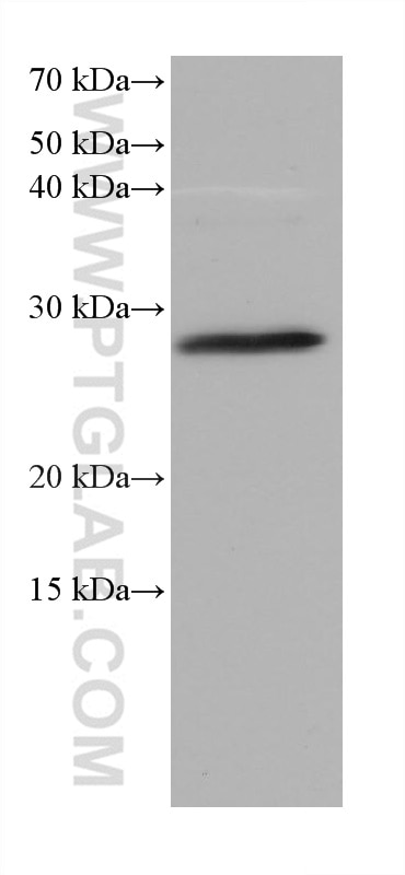 Western Blot (WB) analysis of mouse retina tissue using SYNGR1 Monoclonal antibody (68176-1-Ig)