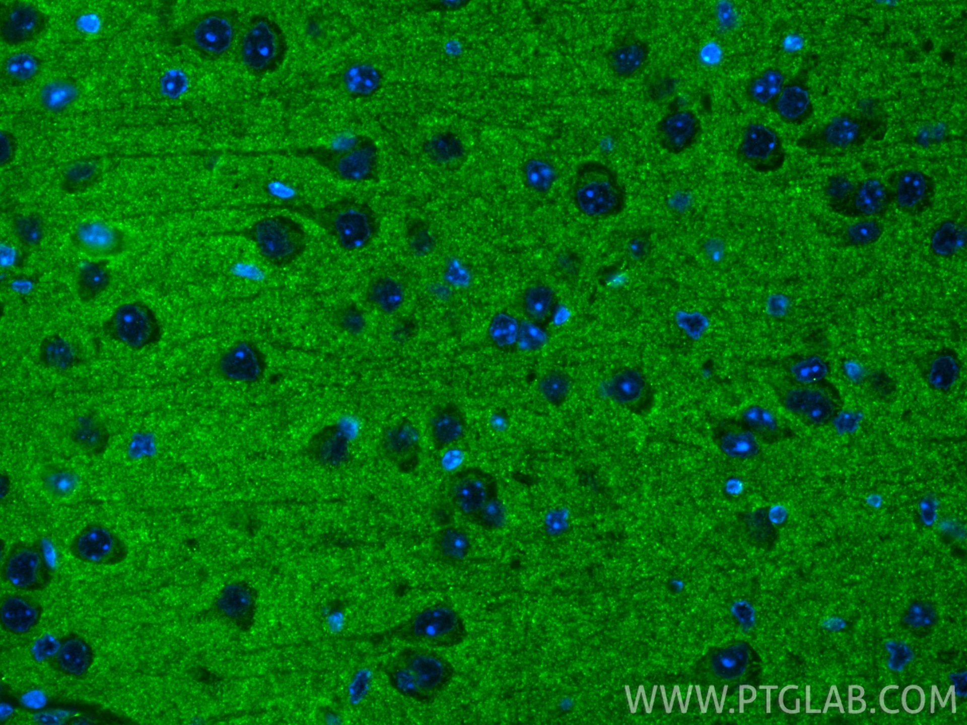 Immunofluorescence (IF) / fluorescent staining of mouse brain tissue using CoraLite® Plus 488-conjugated SYNGR1 Recombinant a (CL488-84161-3)
