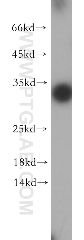 Western Blot (WB) analysis of HepG2 cells using Synaptogyrin-4 Polyclonal antibody (21751-1-AP)