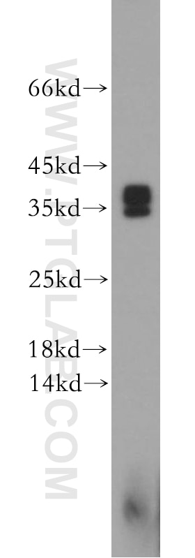 Western Blot (WB) analysis of human brain tissue using Synaptogyrin-4 Polyclonal antibody (21751-1-AP)