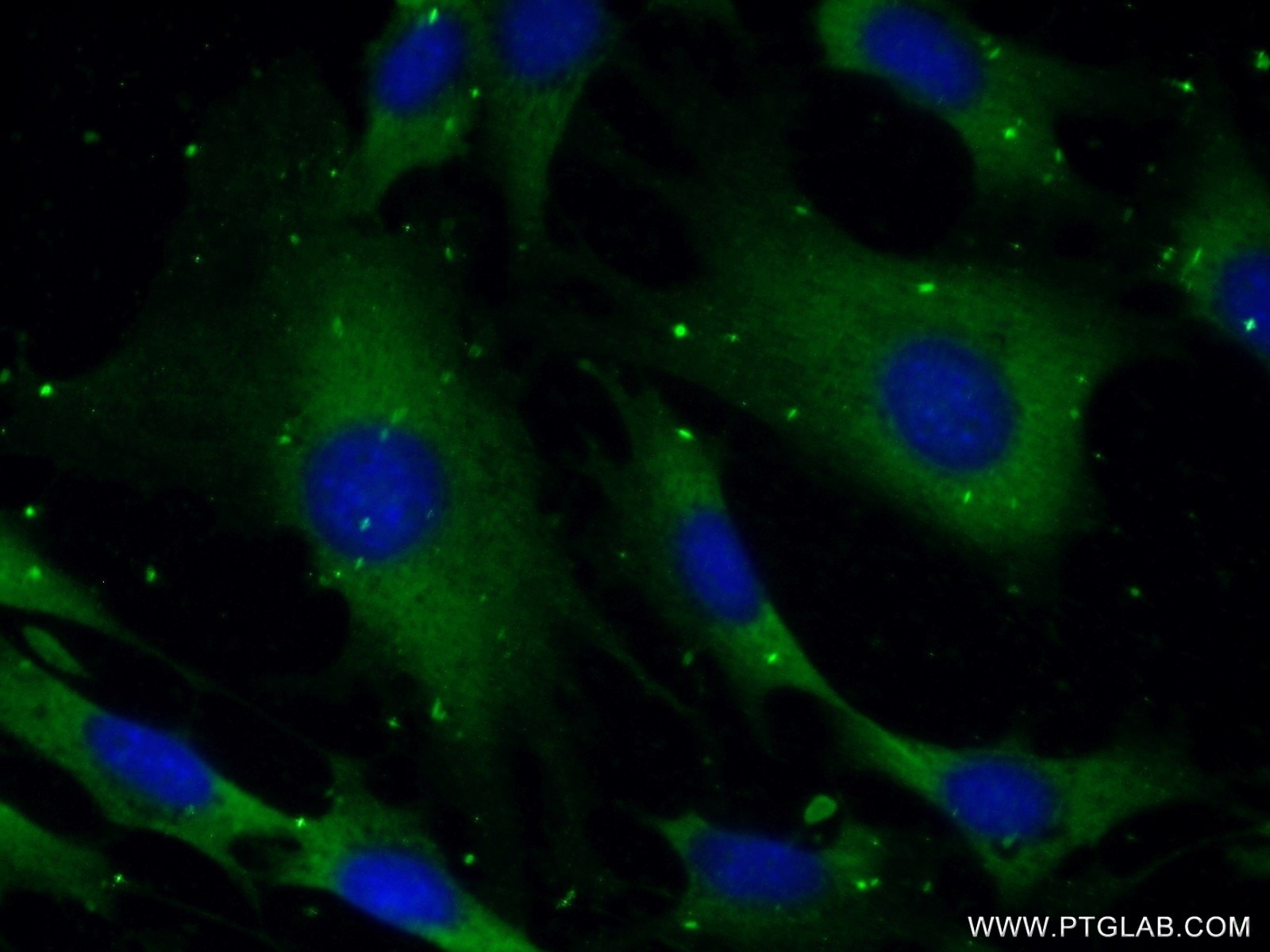 Immunofluorescence (IF) / fluorescent staining of NIH/3T3 cells using SYNJ1 Polyclonal antibody (24677-1-AP)