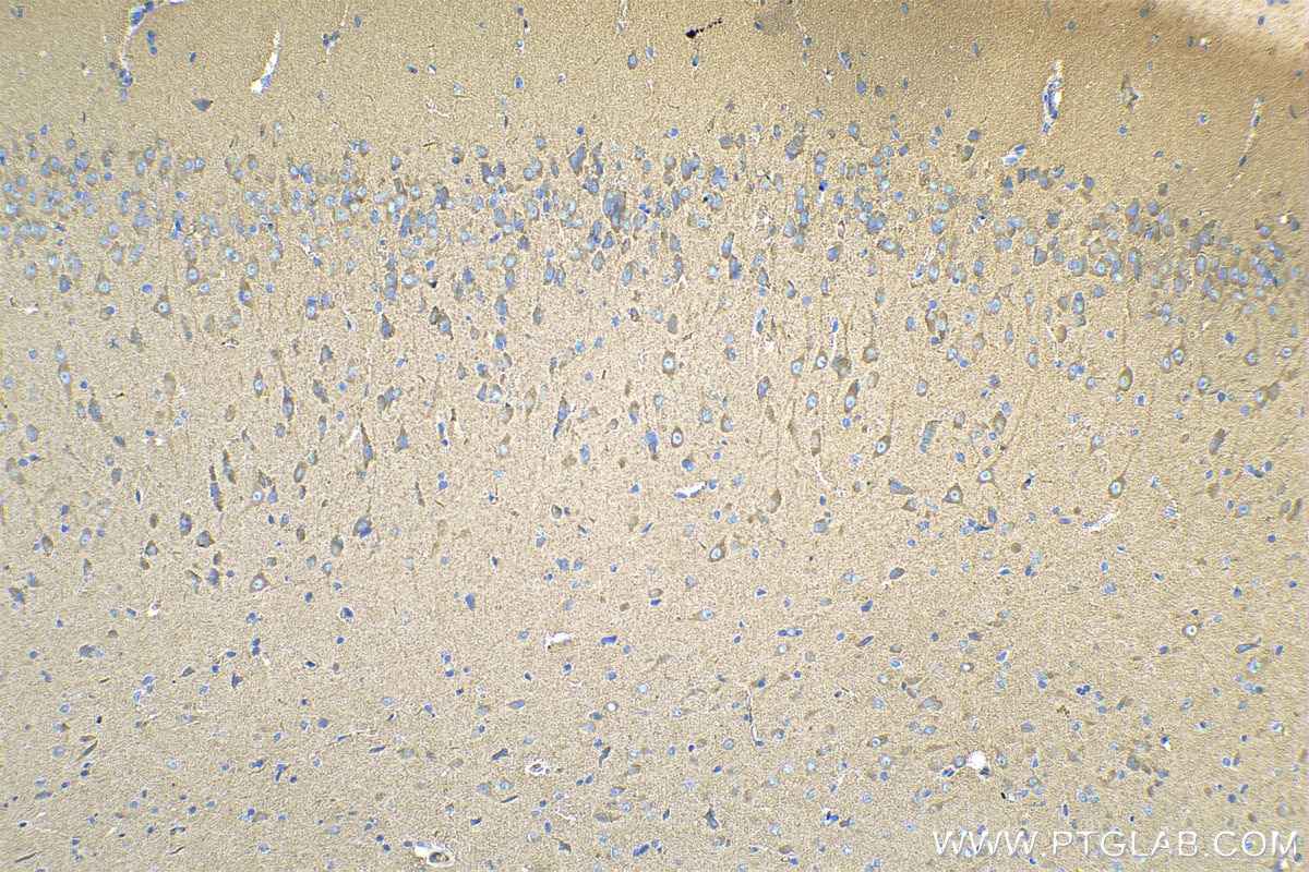 Immunohistochemistry (IHC) staining of rat brain tissue using SYNJ1 Polyclonal antibody (24677-1-AP)