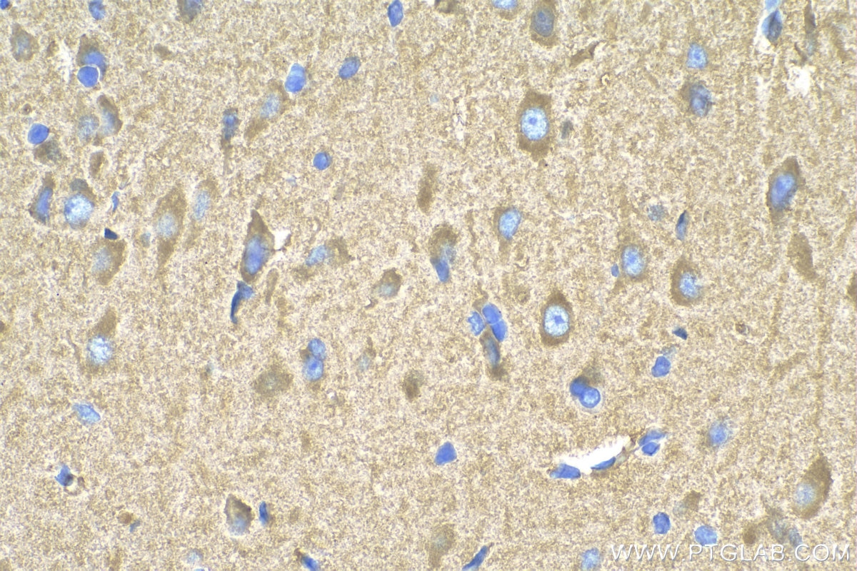 Immunohistochemistry (IHC) staining of rat brain tissue using SYNJ1 Polyclonal antibody (24677-1-AP)