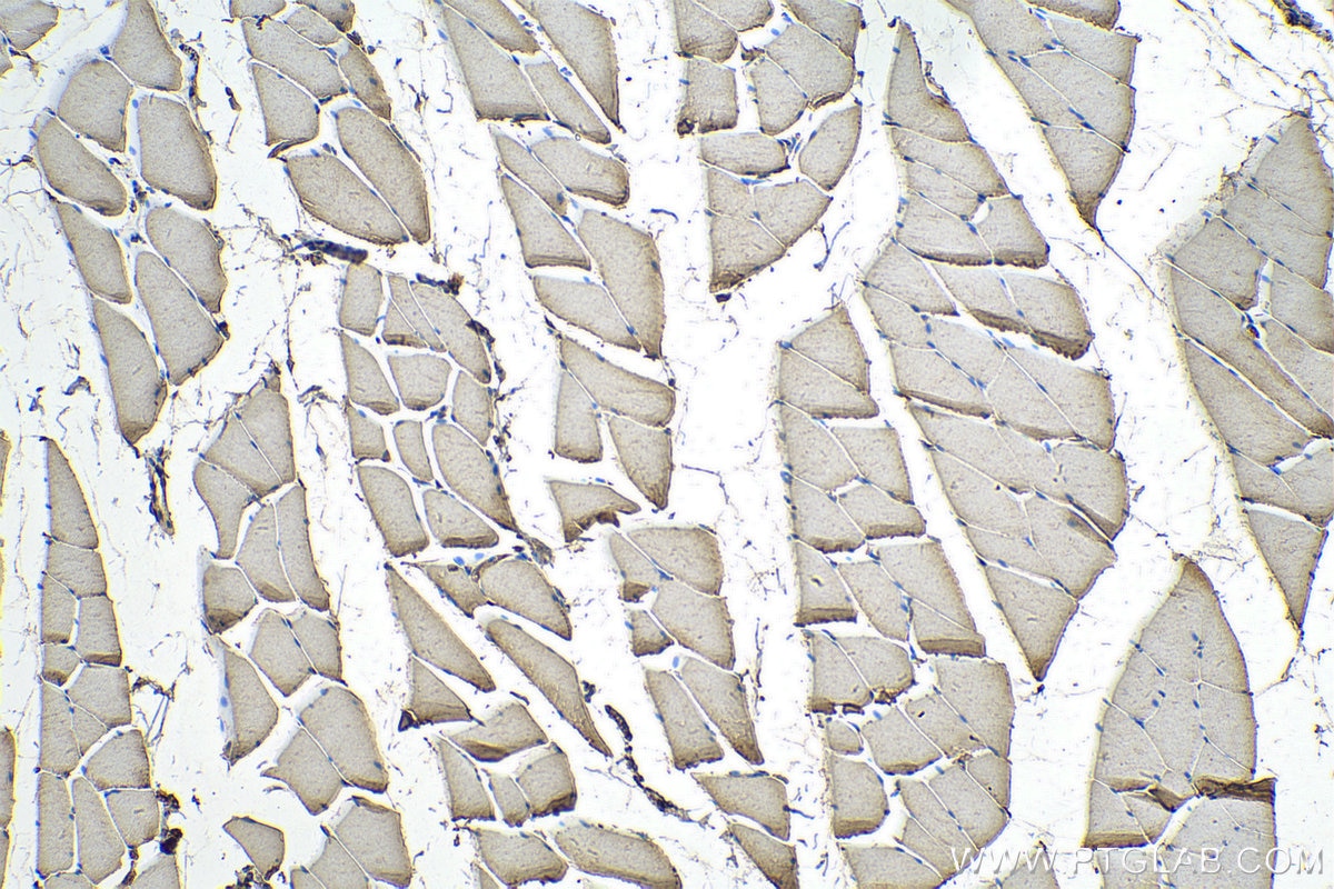 Immunohistochemistry (IHC) staining of rat skeletal muscle tissue using SYNJ1 Polyclonal antibody (24677-1-AP)