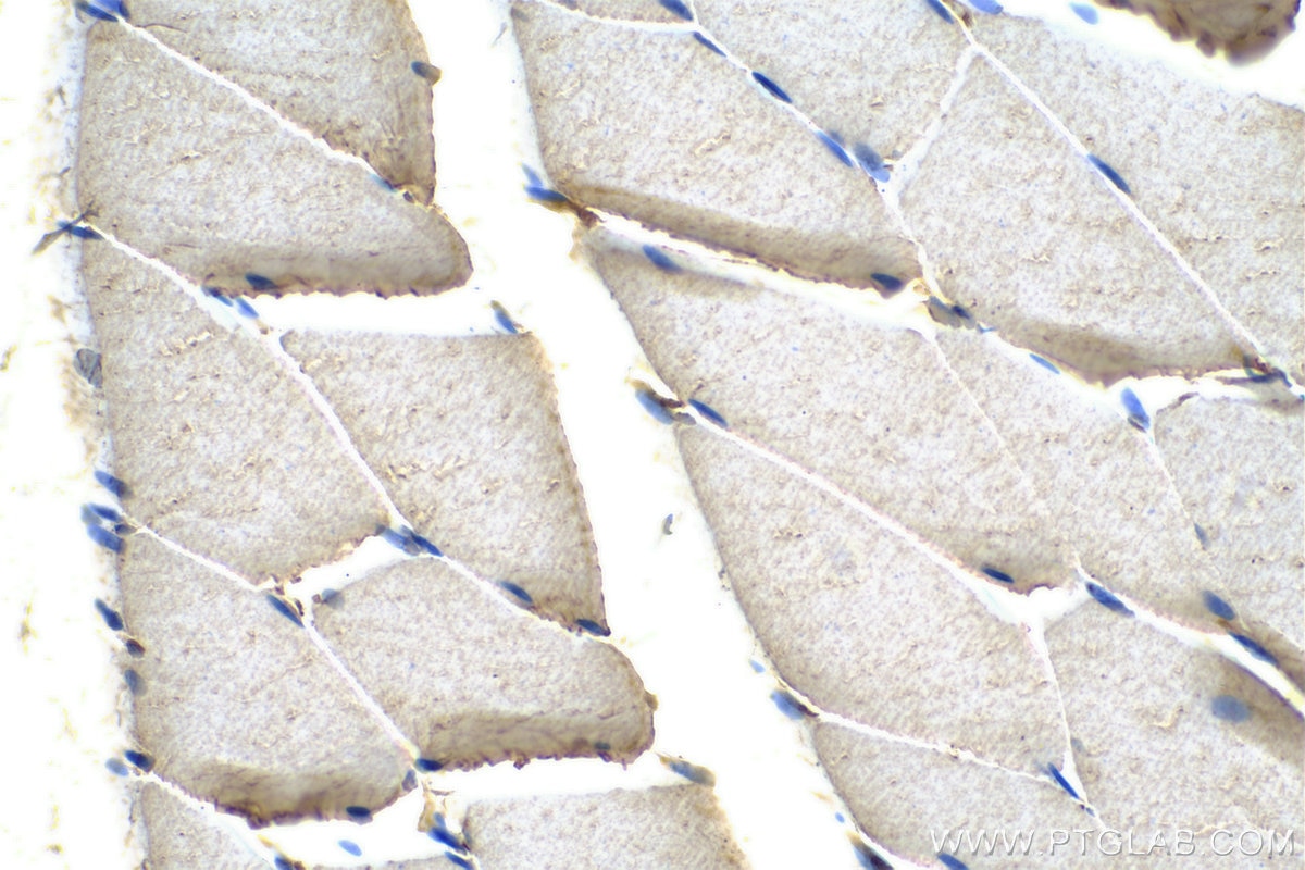 Immunohistochemistry (IHC) staining of rat skeletal muscle tissue using SYNJ1 Polyclonal antibody (24677-1-AP)