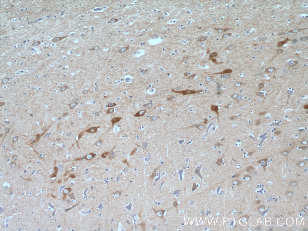 Immunohistochemistry (IHC) staining of human brain tissue using SYNJ1 Polyclonal antibody (24677-1-AP)