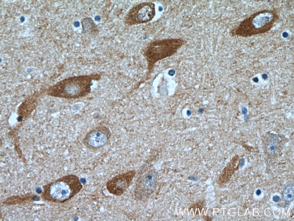 Immunohistochemistry (IHC) staining of human brain tissue using SYNJ1 Polyclonal antibody (24677-1-AP)