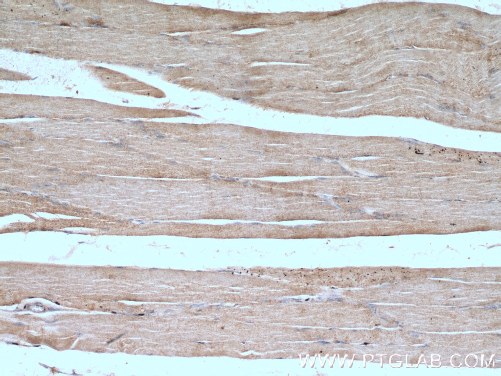 Immunohistochemistry (IHC) staining of human skeletal muscle tissue using SYNJ1 Polyclonal antibody (24677-1-AP)