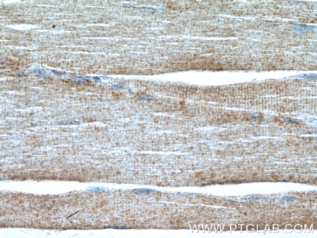 Immunohistochemistry (IHC) staining of human skeletal muscle tissue using SYNJ1 Polyclonal antibody (24677-1-AP)