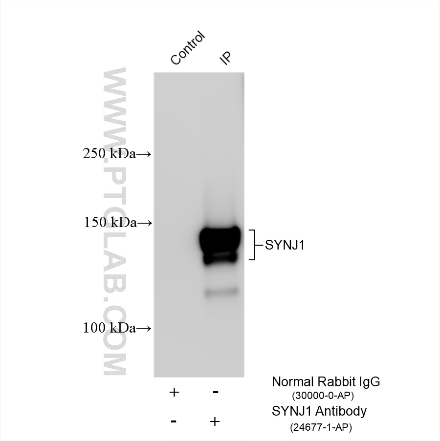 Immunoprecipitation (IP) experiment of mouse brain tissue using SYNJ1 Polyclonal antibody (24677-1-AP)