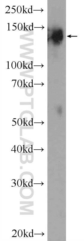 Western Blot (WB) analysis of mouse brain tissue using SYNJ1 Polyclonal antibody (24677-1-AP)