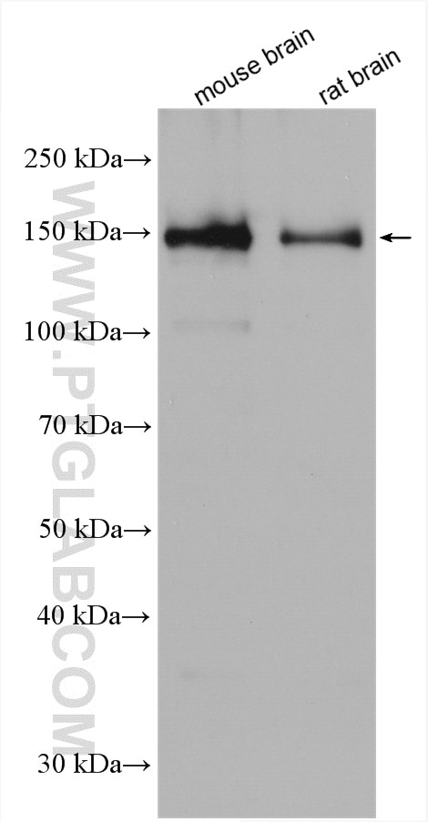 Western Blot (WB) analysis of various lysates using SYNJ1 Polyclonal antibody (24677-1-AP)