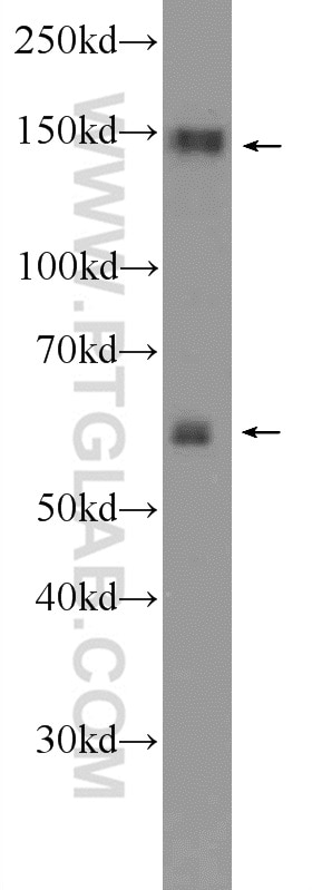 Western Blot (WB) analysis of NIH/3T3 cells using SYNJ1 Polyclonal antibody (24677-1-AP)