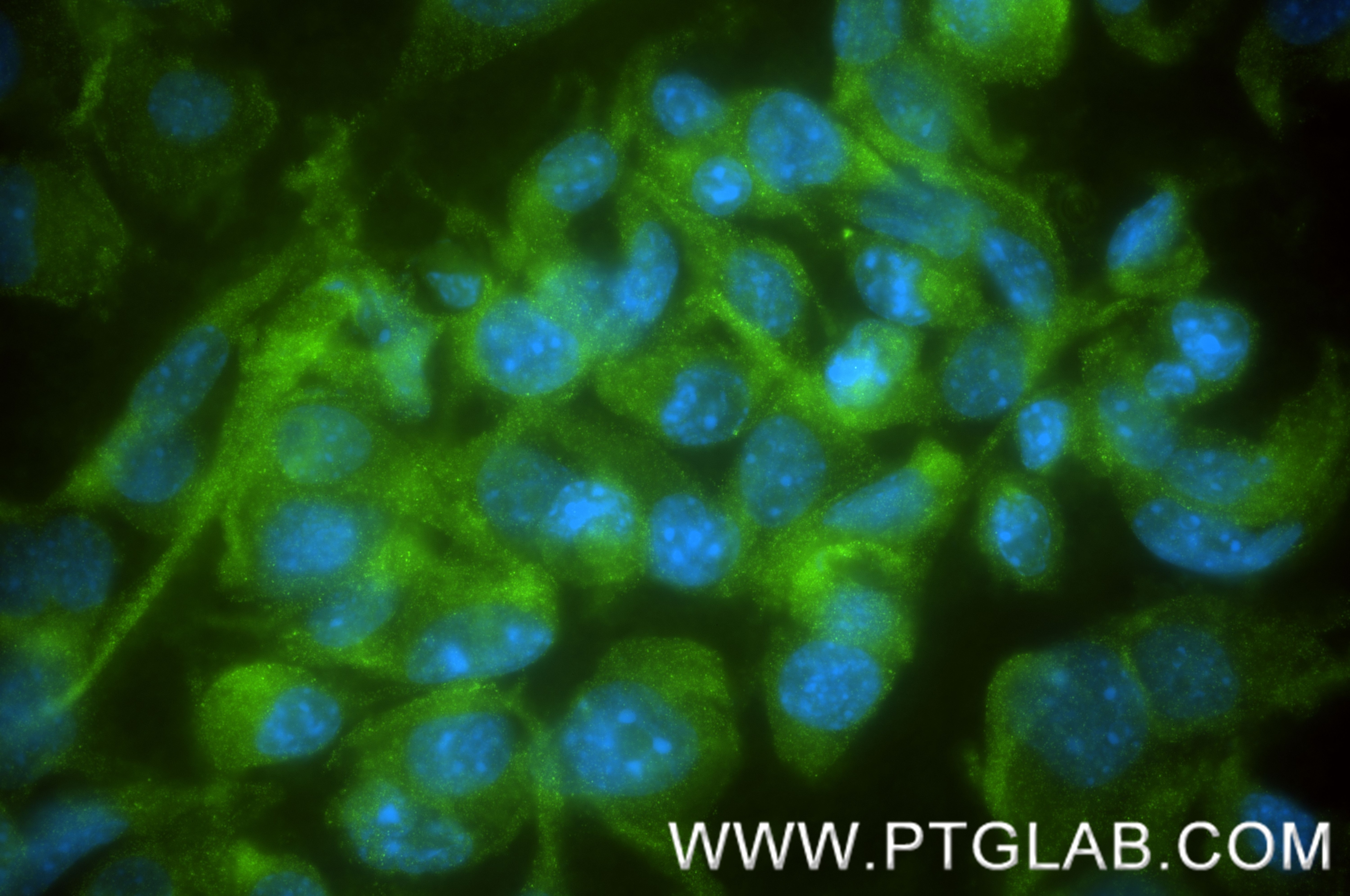 IF Staining of NIH/3T3 using 87620-1-RR Immunofluorescence (IF) / fluorescent staining of NIH/3T3 cells using SYNJ1 Recombinant monoclonal antibody (87620-1-RR)