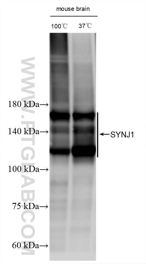 WB analysis using 87620-3-RR Western Blot (WB) analysis of various lysates using SYNJ1 Recombinant monoclonal antibody (87620-3-RR)