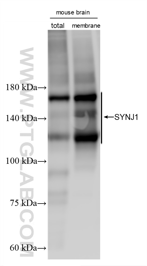 WB analysis using 87620-3-RR Western Blot (WB) analysis of various lysates using SYNJ1 Recombinant monoclonal antibody (87620-3-RR)