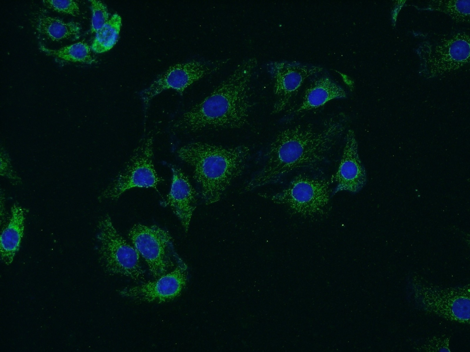Immunofluorescence (IF) / fluorescent staining of SH-SY5Y cells using Synaptojanin 2 Polyclonal antibody (13893-1-AP)