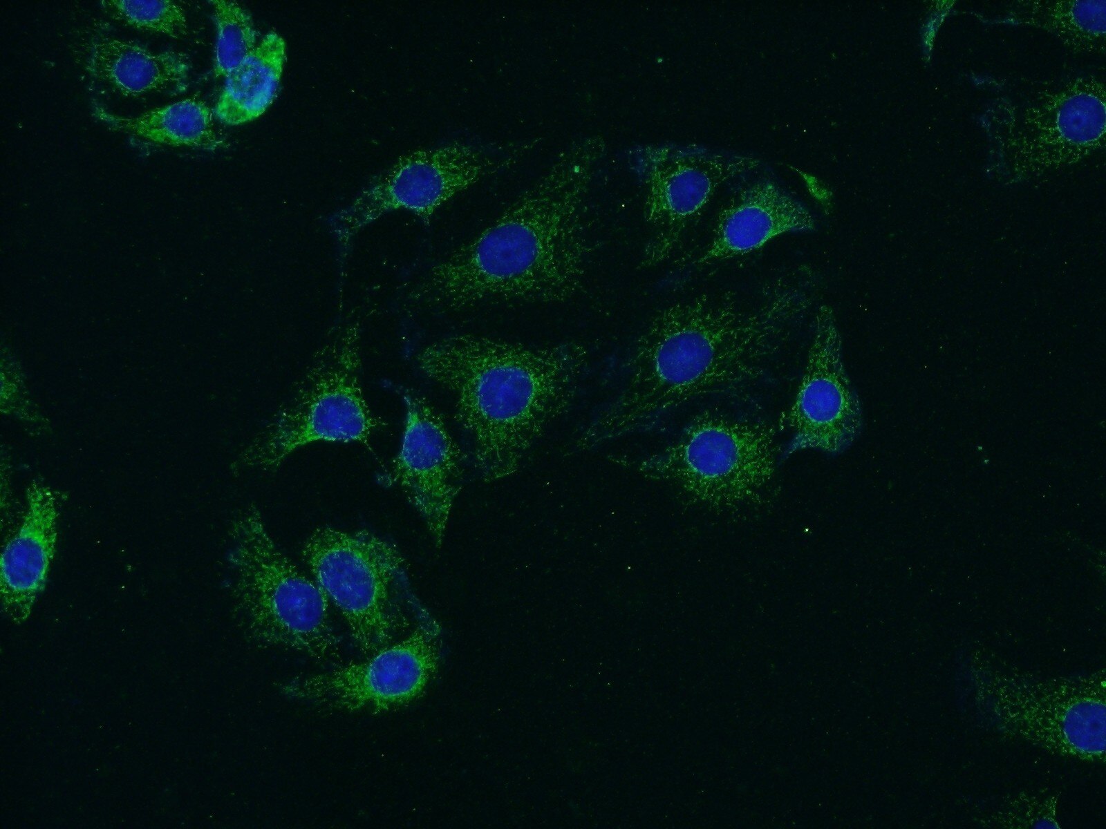 Synaptojanin 2
