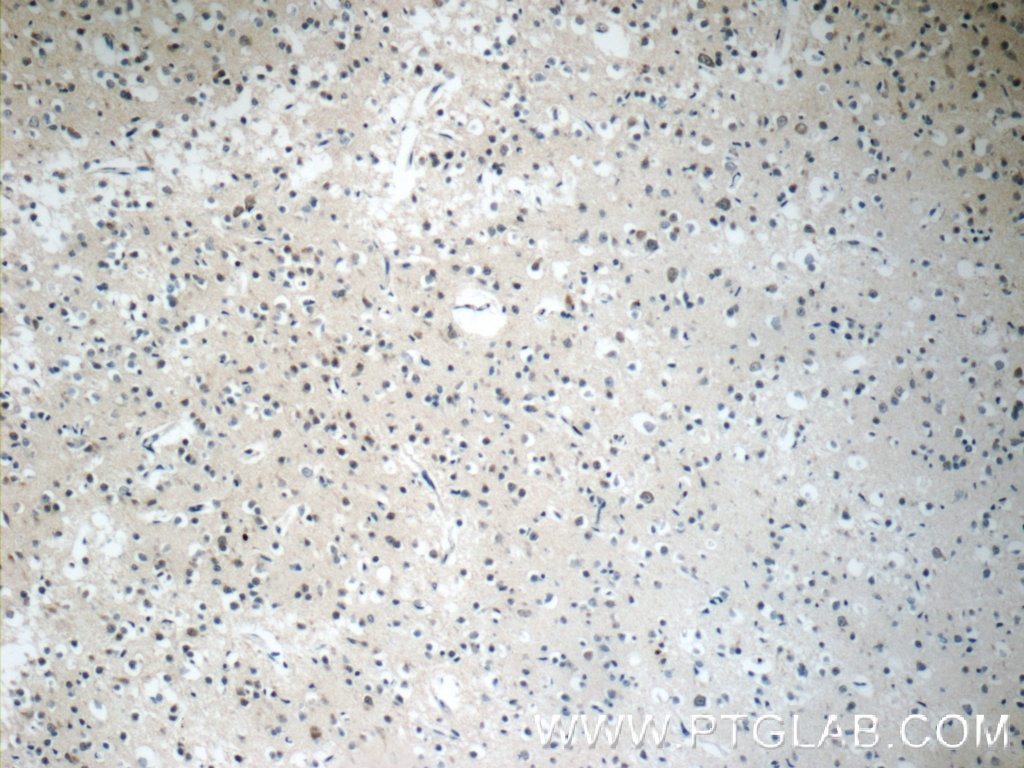 Immunohistochemistry (IHC) staining of human brain tissue using Synaptojanin 2 Polyclonal antibody (13893-1-AP)