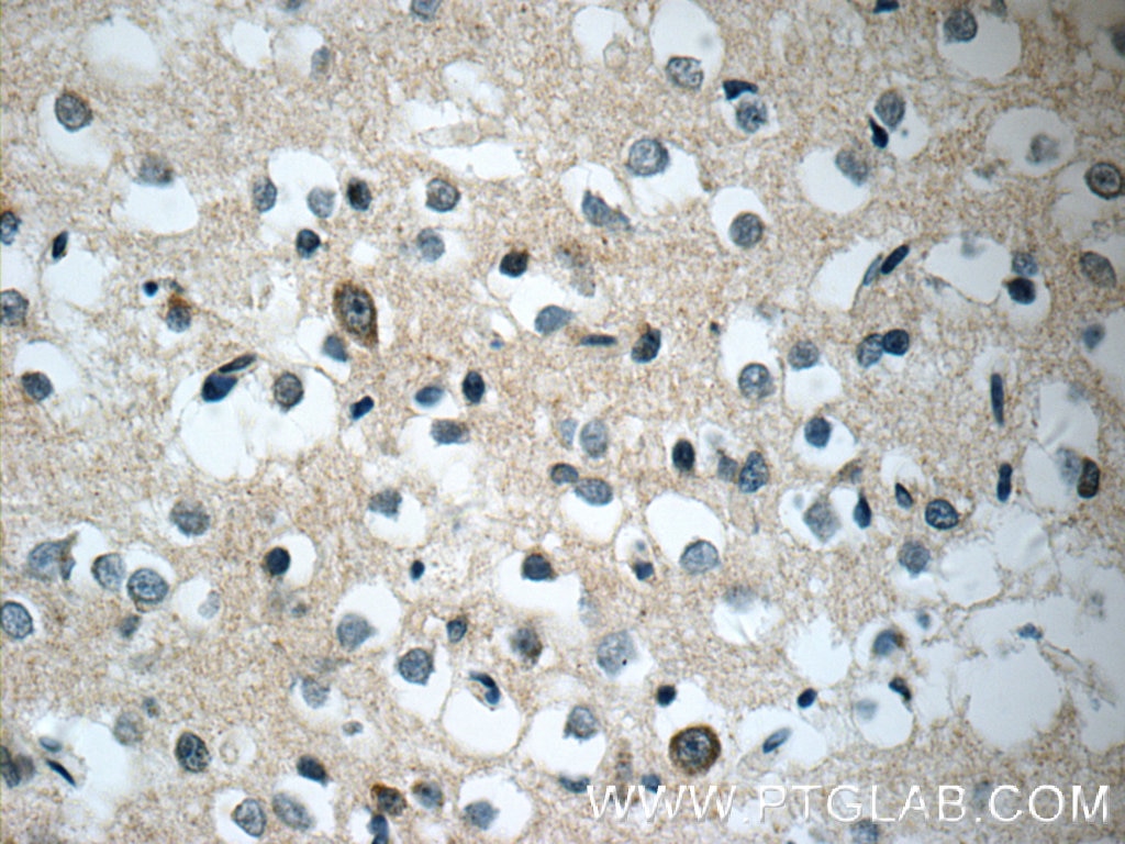 Immunohistochemistry (IHC) staining of human brain tissue using Synaptojanin 2 Polyclonal antibody (13893-1-AP)