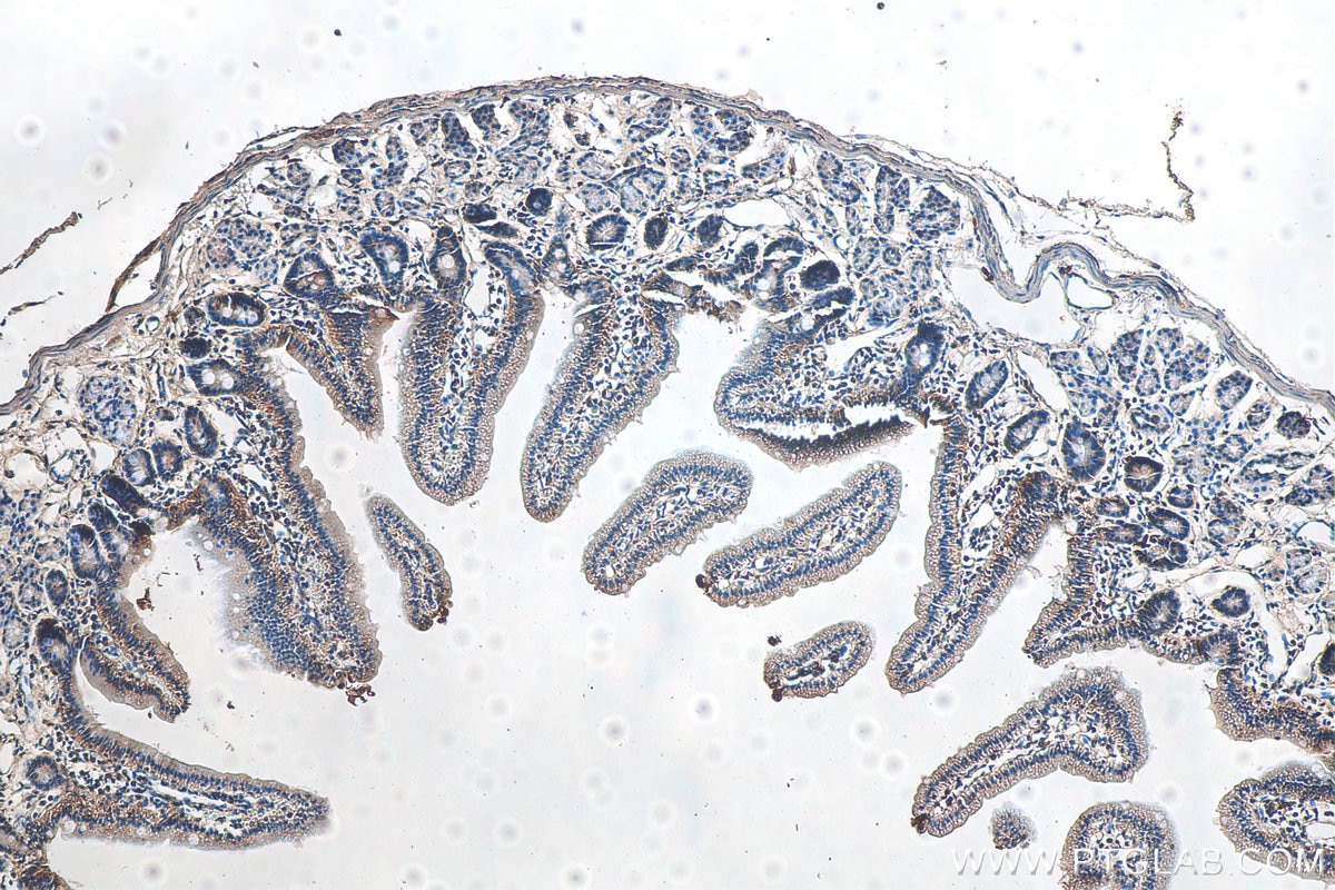 Immunohistochemistry (IHC) staining of mouse small intestine tissue using Synaptojanin 2 Polyclonal antibody (13893-1-AP)