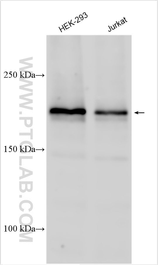 Western Blot (WB) analysis of various lysates using Synaptojanin 2 Polyclonal antibody (13893-1-AP)