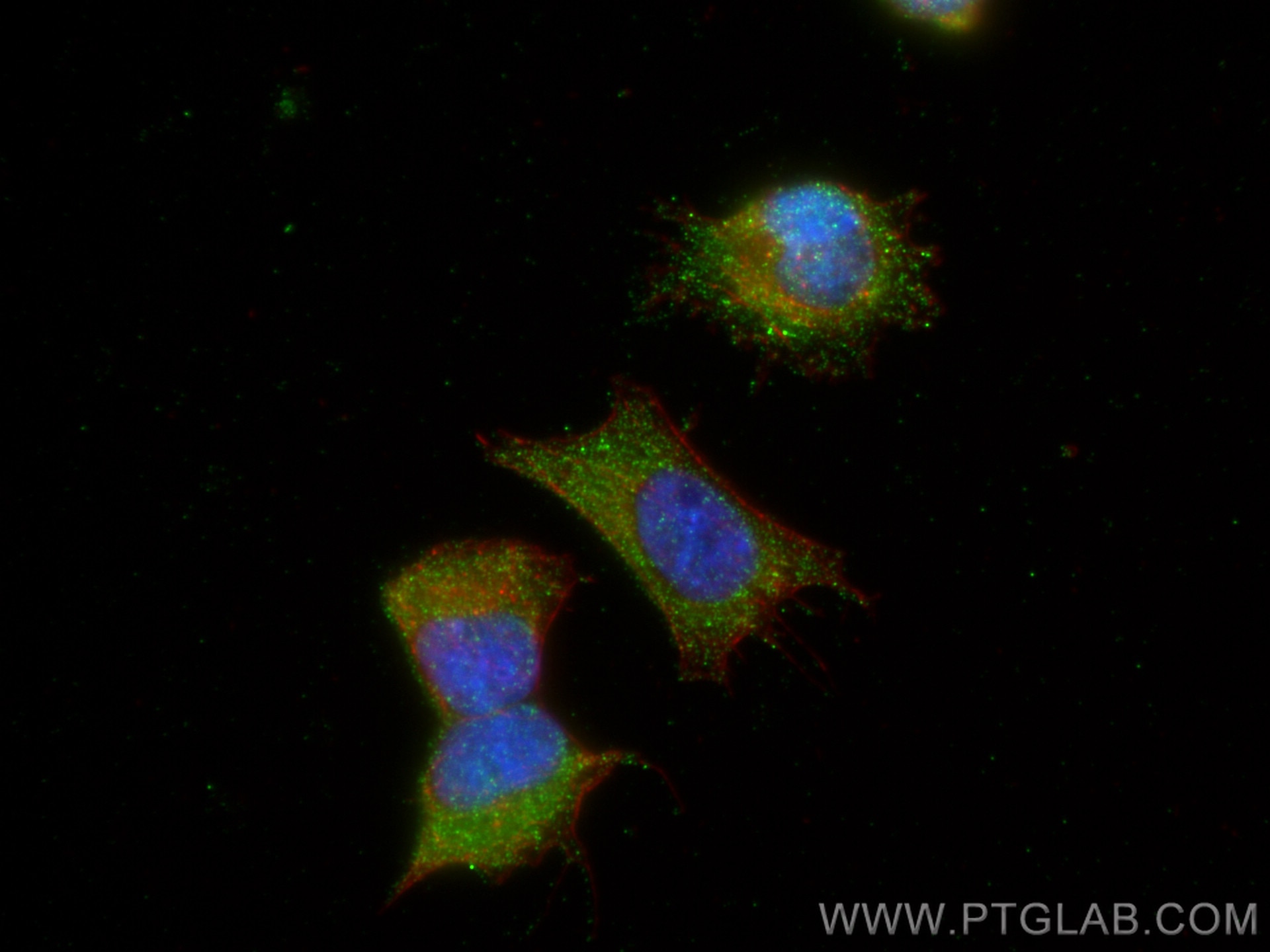 Immunofluorescence (IF) / fluorescent staining of SH-SY5Y cells using SYNJ2 Polyclonal antibody (30391-1-AP)