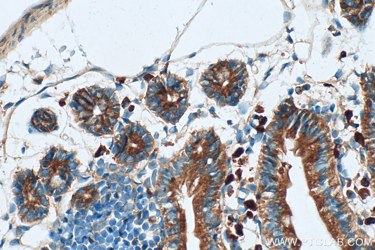 Immunohistochemistry (IHC) staining of mouse small intestine tissue using SYNJ2 Polyclonal antibody (30391-1-AP)