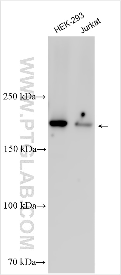 Western Blot (WB) analysis of various lysates using SYNJ2 Polyclonal antibody (30391-1-AP)