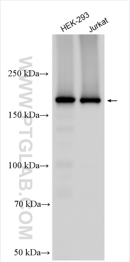 Western Blot (WB) analysis of various lysates using SYNJ2 Polyclonal antibody (30391-1-AP)