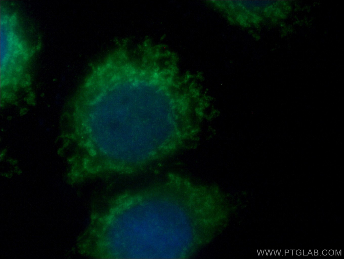 Immunofluorescence (IF) / fluorescent staining of HepG2 cells using SYNJ2BP Polyclonal antibody (15666-1-AP)