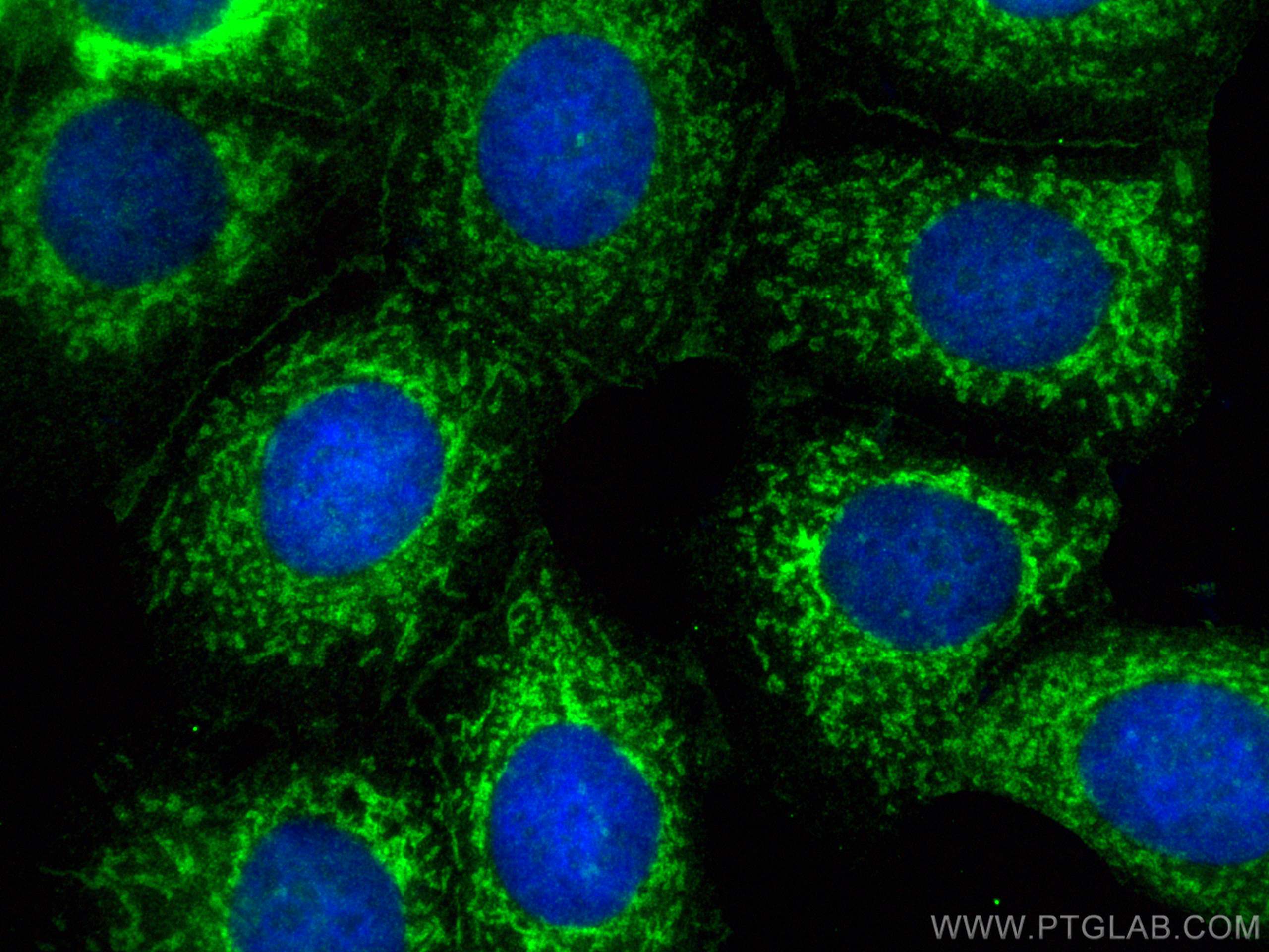 Immunofluorescence (IF) / fluorescent staining of MCF-7 cells using SYNJ2BP Polyclonal antibody (15666-1-AP)