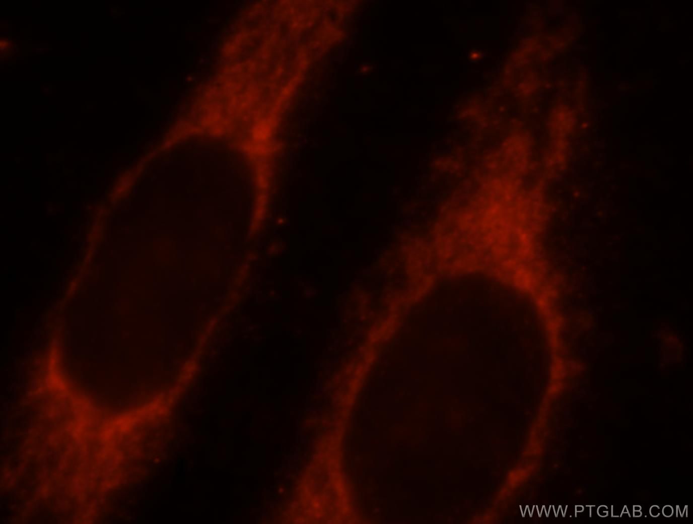 Immunofluorescence (IF) / fluorescent staining of MCF-7 cells using SYNJ2BP Polyclonal antibody (15666-1-AP)