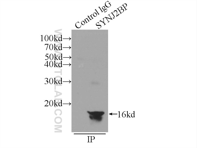Immunoprecipitation (IP) experiment of mouse lung tissue using SYNJ2BP Polyclonal antibody (15666-1-AP)